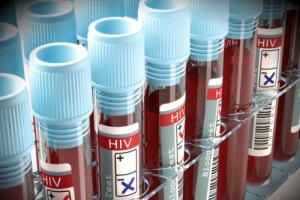 Regras para coleta de material biológico para teste de detecção do HIV - métodos para diagnóstico de infecção